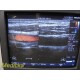 Philips L15-7io Linear Array Intraoperative Hockey Ultrasound Transducer ~ 31259