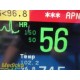 2010 Philips 862135 Monitor, MP30 W/ M3001A MMS Module MASIMO SpO2& Leads ~31668