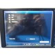 2017 Philips 863283 Sure Signs VS4 Monitor W/ New Patient Leads ~ 31936
