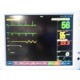 2010 Fukuda Denshi DS-7210/DS-7200 Dynascope Monitor W/ Patient Leads ~ 31929