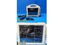 Pace Tech Inc Vitalmax 4000 Vitals Monitor W/ PSU & Tele Device ~ 32354