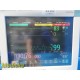 Philips Intellivue Critical Care MP70 Monitor W/ MMS,Recorder Mod + Leads ~32333