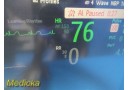 Philips Intellivue Critical Care MP70 Monitor W/ MMS,Recorder Mod + Leads ~32333