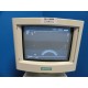 2004 Siemens Sonoline G20 Ultrasound W/ EV9-4 Endo-cavity Transducer ~10968