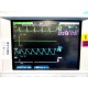 HP Viradia 24C CRITICAL CARE Color Patient Monitor W/ Rack Modules & Leads~12242