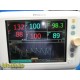Philips VS3 Sure Signs 863074 Spot Vitals Monitor W/ Leads & Stand ~ 33831