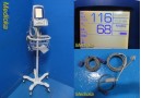 Welch Allyn Spot Vital Signs LXI Monitor Nellcor SpO2 W/ 2X Leads & Stand ~33667
