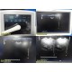 Philips IU22 XMatrix Ultrasound W/ L12-5, C8-4V & C8-5 Probes, Loaded, F1~ 33712