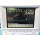 HP V24CT Trasnsport Patient Monitor (CO2 NBP SpO2 EKG Print) W/ Cables (11134)