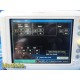 Philips VS3 SureSigns 863073 Spot Vitals Monitor W/ Leads & Client Bridge ~34135