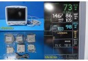 GE Dash 5000 Patient Monitor (IPB,NBP,ECG,SpO2,TEMP,CO2) W/ NEW Leads ~ 34091