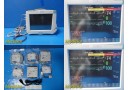 Philips Intellivue MP50 Monitor W/ Leads & Press CO Print & MMS Modules ~ 34078