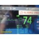 Philips Intellivue MP50 Anesthesia Monitor(M3001A MMS & IBP Module Leads)~ 34174