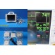 GE Patient Monitor Dash 3000 (NBP,Temp,SpO2,ECG & Print) &Accessory Leads~34310