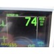GE Patient Monitor Dash 3000 (NBP,Temp,SpO2,ECG & Print) &Accessory Leads~34310