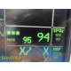 GE Patient Monitor Dash 3000 (NBP,Temp,SpO2,ECG & Print) &Accessory Leads~34310