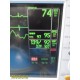 GE Patient Monitor Dash 3000 (NBP,Temp,SpO2,ECG & Print) &Accessory Leads~34310