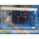 Philips MP70 (M8007A) Neonatal Pt. Monitor W/ Printer & MMS Modules Leads~ 34486
