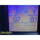 Welch Allyn 45NTO Spot Vital Signs LXI Monitor W/ Leads (TEMP, NBP, SPO2) ~34916