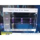 2018 Philips Intellivue MP5SC Spot Check Monitor W/ SpO2, NBP, Temp Leads ~35106