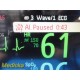 Philips MP30 (M8002A) Anesthesia Monitor W/ MMS Module & Leads Masimo SpO2~35177