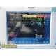 Philips MP50 Critical Care Monitor W/ Leads & BIS Press MMS Print Modules ~35207