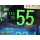 Philips MP30 Anesthesia Patient Monitor W/ M3001A MMS Module & Leads ~ 35344
