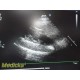 Philips S5-1 P/N 21314A Sector Array Ultrasound Transducer Probe ~ 35346