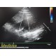 Philips S5-1 P/N 21314A Sector Array Ultrasound Transducer Probe ~ 35346