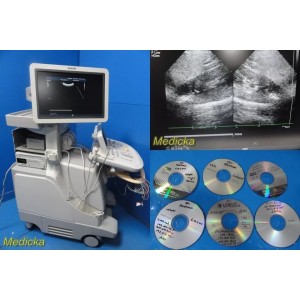 https://www.themedicka.com/21013-252427-thickbox/philips-ie33-diag-cardiac-ultrasound-w-s5-1-s12-4-c9-4-pencil-probes35347.jpg