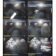 Philips IE33 Diag. Cardiac Ultrasound W/ S5-1, S12-4, C9-4 & Pencil Probes~35347