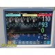 2010 Philips Intellivue MP30 Anesthesia Patient Monitor W/ Module & Leads ~35318