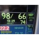 GE Transport Pro Patient Monitor W/ Tram 451M Module, NEW Leads & PSU ~ 35358