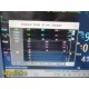 Philips Intellivue MP20 Monitor Ref M8001A W/ MMS Module, Leads & Antenna ~35390