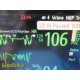 Philips Intellivue MP20 Monitor Ref M8001A W/ MMS Module, Leads & Antenna ~35403