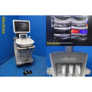 https://www.themedicka.com/21170-255428-thickbox/philips-iu22-diag-ultrasound-w-l17-5-l15-7io-c8-5-probes-foot-control-35682.jpg