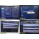 Philips iU22 Diag Ultrasound W/ L17-5, L15-7io, C8-5 Probes &Foot Control ~35682