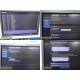 Philips iU22 Diag Ultrasound W/ L17-5, L15-7io, C8-5 Probes &Foot Control ~35682