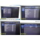 Philips iU22 Diag Ultrasound W/ L17-5, L15-7io, C8-5 Probes &Foot Control ~35682