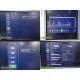 Philips iU22 Diag Ultrasound W/ L17-5, L15-7io, C8-5 Probes &Foot Control ~35682
