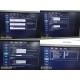 Philips iU22 Diag Ultrasound W/ L17-5, L15-7io, C8-5 Probes &Foot Control ~35682