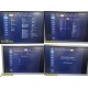 Philips iU22 Diag Ultrasound W/ L17-5, L15-7io, C8-5 Probes &Foot Control ~35682