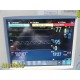 2010 Philips Intellivue MP20 Monitor Ref M8002A W/ MMS Module & Leads ~ 35414