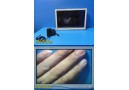 Stryker 26" Vision Elect HDTV Surgical Monitor Ref 240-030-960 W/ Adapter ~35703