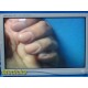 Stryker 26" Vision Elect HDTV Surgical Monitor Ref 240-030-960 W/ Adapter ~35703