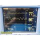 Datascope 0998-00-0170-0014A Passport 2 Patient Monitor W/O Leads ~ 35479