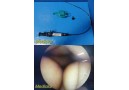 Olympus LF-GP Flexible Tracheal Intubation Fiber Scope W/ Scope Valve ~ 35471