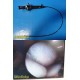 Olympus LF-GP Flexible Tracheal Intubation Fiber Scope (7 BROKEN FIBERS) ~ 35473