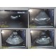 Sonosite Titan P04240-10 High Resolution Ultrasound Console (For Parts) ~ 35463