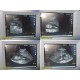 Sonosite Titan P04240-10 High Resolution Ultrasound Console (For Parts) ~ 35463